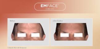 Luminisce introduces EMFACE, a ground-breaking anti-aging technology